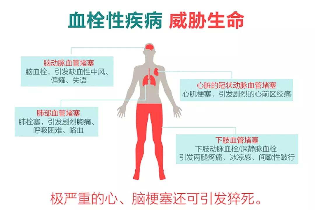 预防血栓的利伐沙班怎么吃