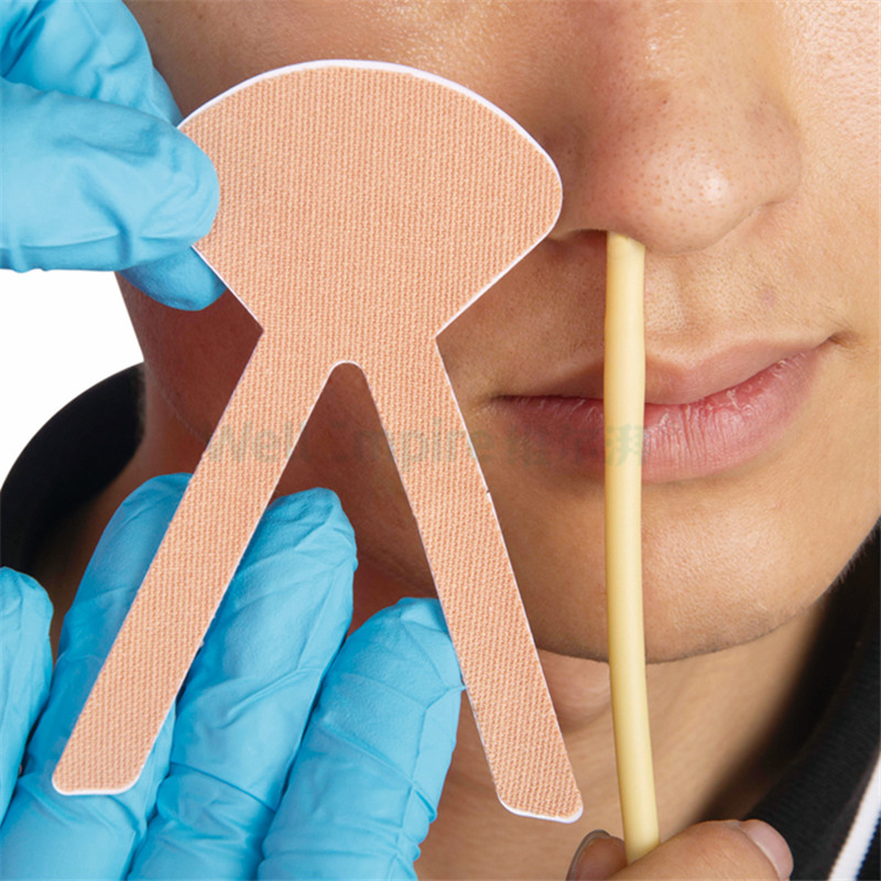 鼻饲管护理记录单咋写