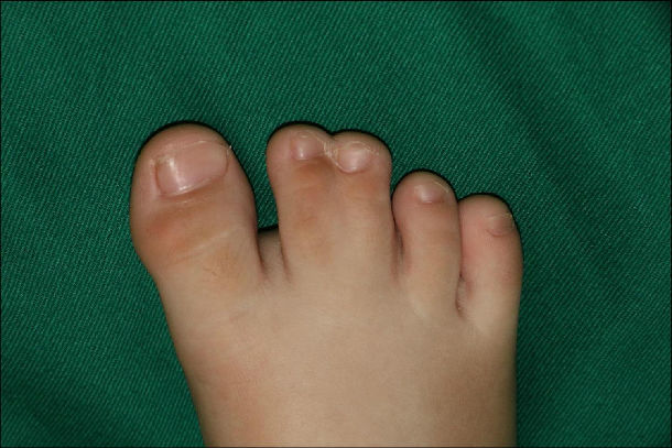 定义和指征大写怎么写