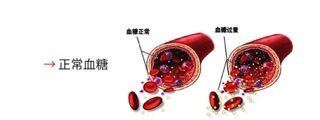 高血糖要注意哪些饮食不能吃
